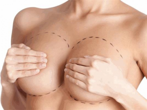 Mellnagyobbítás árak