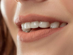 fogtömések élettartama