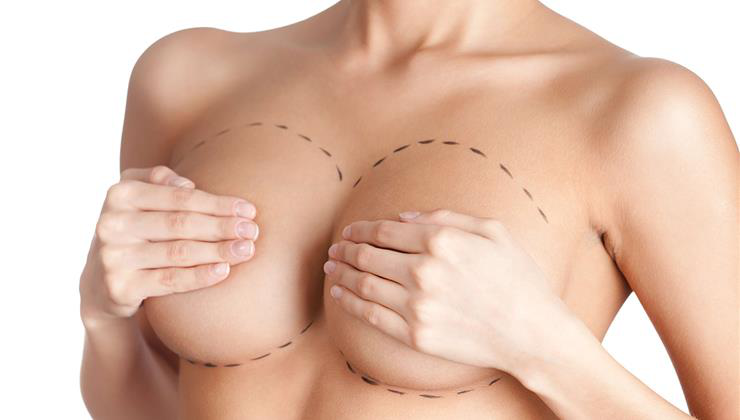 Mellnagyobbítás árak