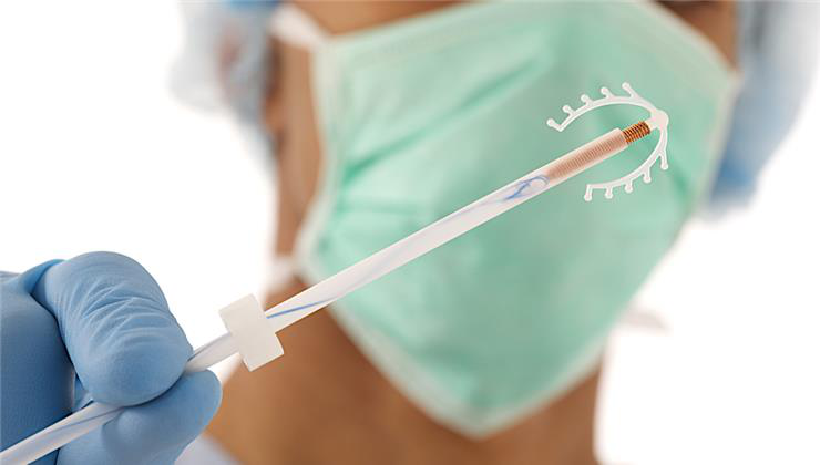 spirál, fogamzásgátlás