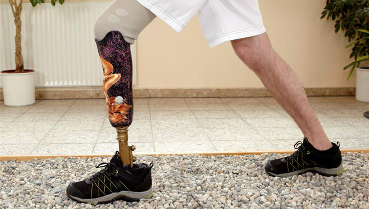 gondolat-vezérelt protézis