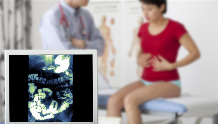 rövidbél-szindróma, zebrahal