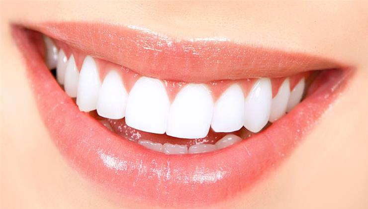 fogfehérítés házilag